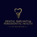 DENTAL IMPLANTS and PERIODONTAL HEALTH